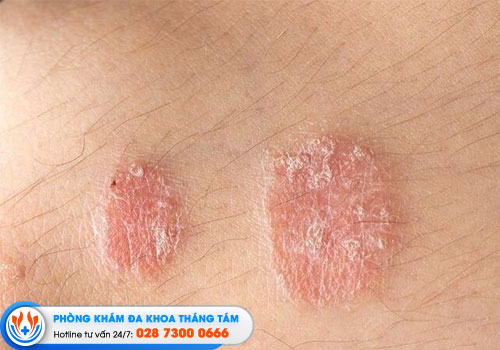 10-phong-kham-da-lieu-quan-10-co-bac-si-gioi