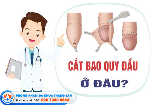 cat-bao-quy-dau-o-binh-phuoc-top-6-co-so-uy-tin-chat-luong